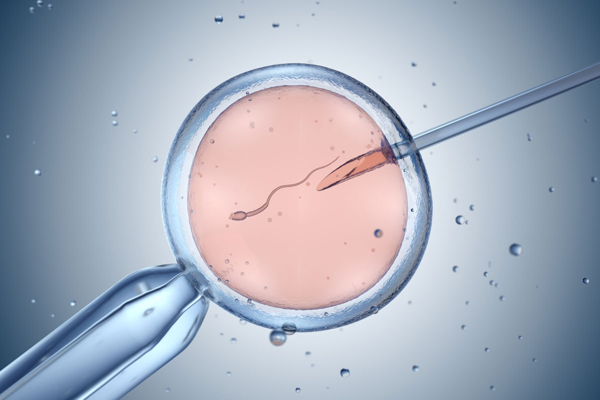Urgent Shipping Of Frozen Eggs For IVF Case Study